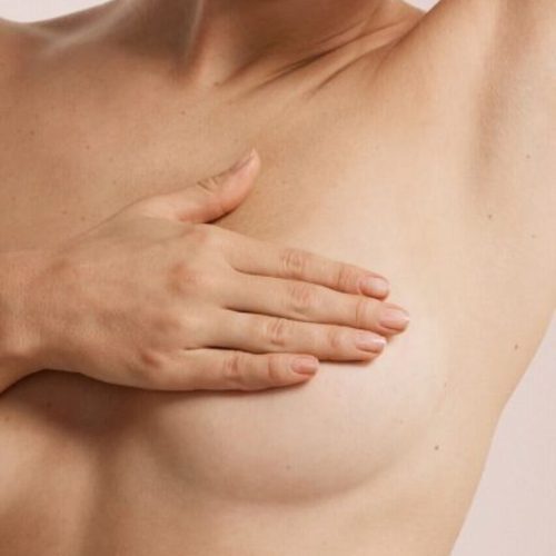 Terapia reafirmante de senos